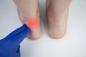 achilles heel pain