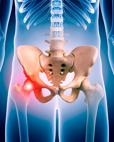 Joint Replacement near me - hip replacement surgery indiana - knee replacement surgery indiana - shoulder replacement surgery indiana - orthopedic surgeons near me - OSMC 